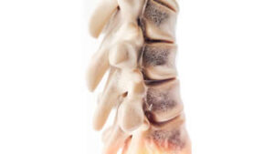 Osteoporosis & Calcium Abnormalities