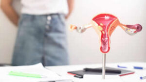 Polycystic Ovarian Syndrome